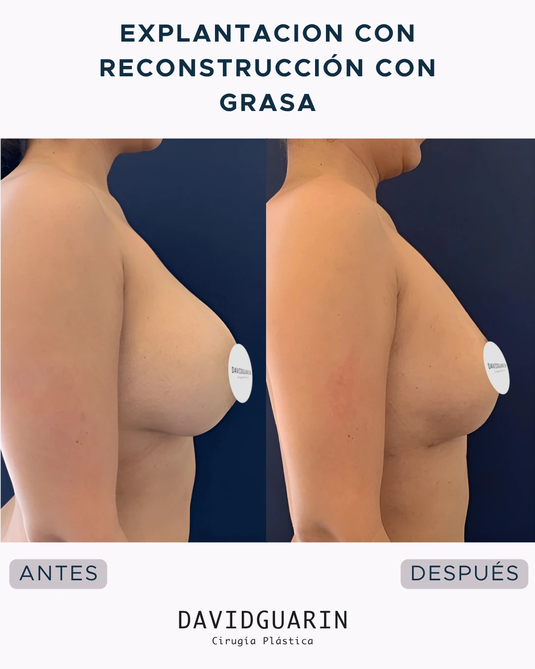 Before and after